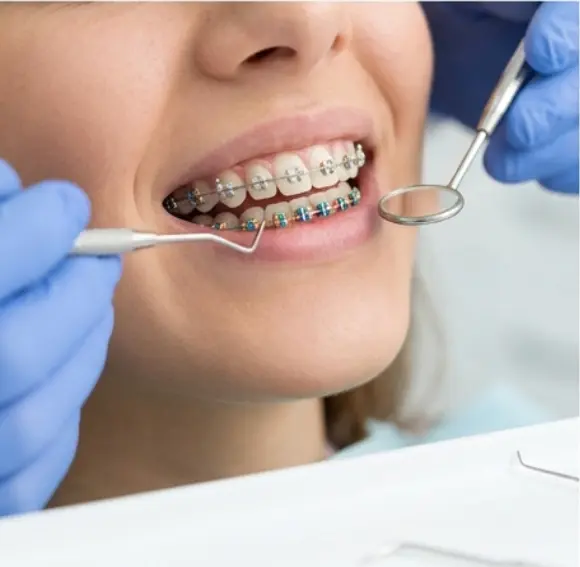 Orthodontic Treatment